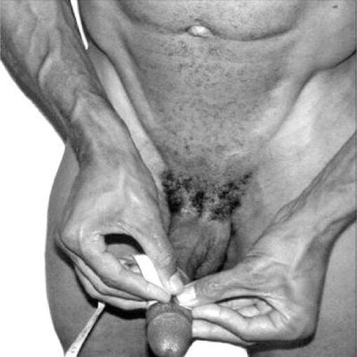 μέτρηση πέους πριν από τη μεγέθυνση